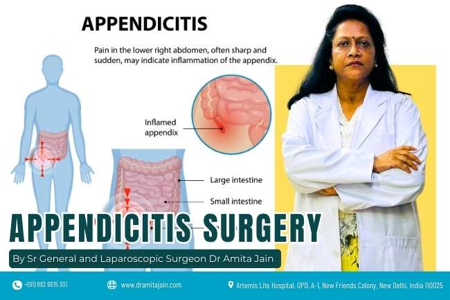 Dr Amita Jain Specialized Surgeon for appendicitis surgeries